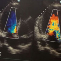 Integrated Ultrasound in Management of Sepsis: Case Report